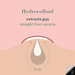 OyzekX Pimple Patch For Face