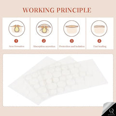 OyzekX Pimple Patch For Face | 36 Hydrocolloid Pimple Patches | 2% w/w Salicylic Acid, Neem, Cica | Helps Reduce Pimples, Redness & Irritation | Absorbs Excess Oil | Safe for All Skin Types (36 pcs-White)