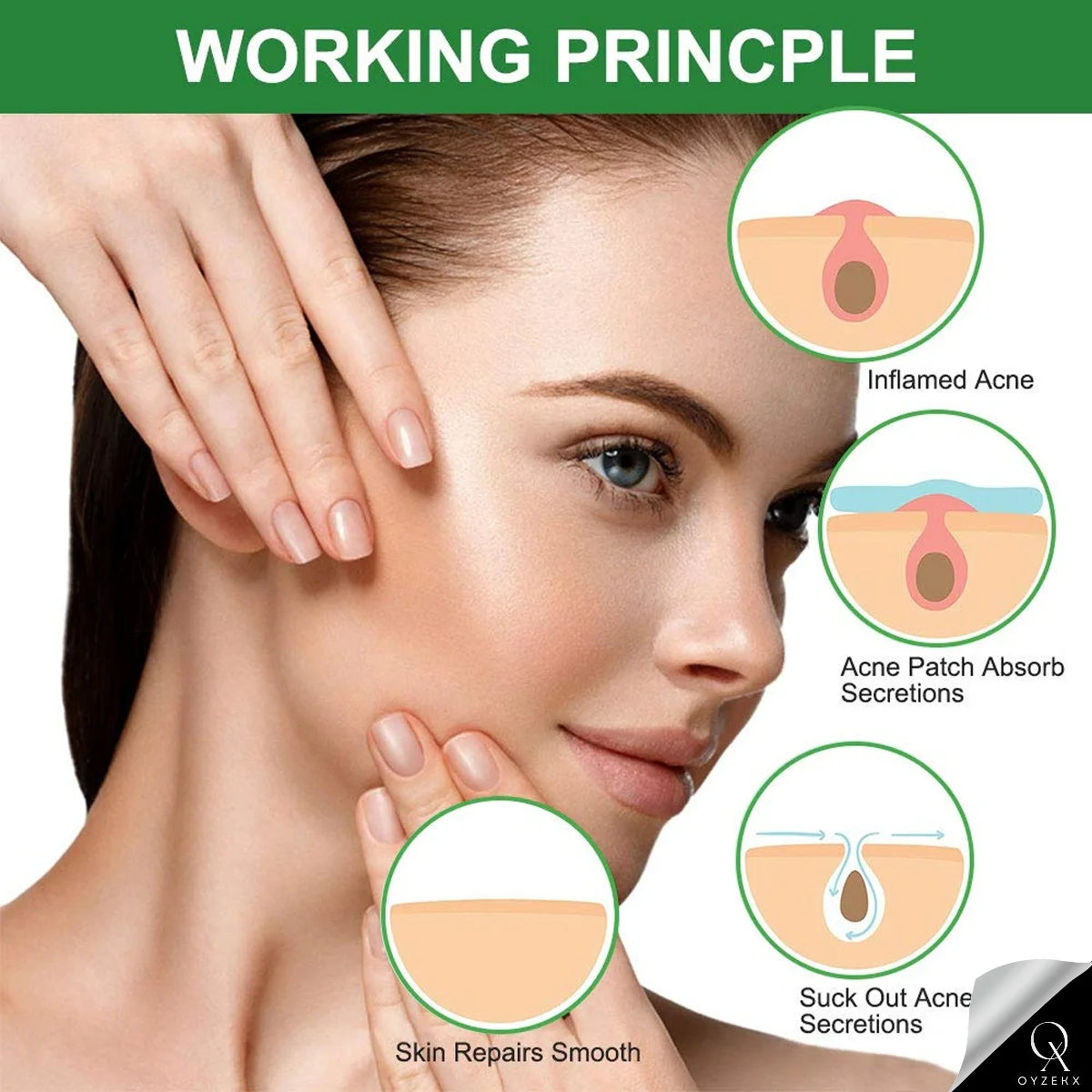 OyzekX Pimple Patch For Face | 36 Hydrocolloid Pimple Patches | 2% w/w Salicylic Acid, Neem, Cica | Helps Reduce Pimples, Redness & Irritation | Absorbs Excess Oil | Safe for All Skin Types (36 pcs-White)